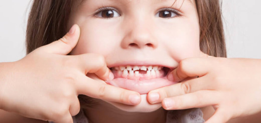 caries ok
